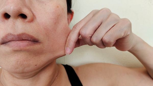 Jowls & Jawline Definition
