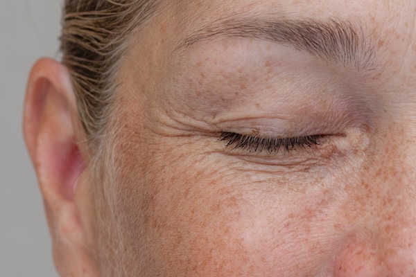 Hooded Eyes & Heavy Brow
