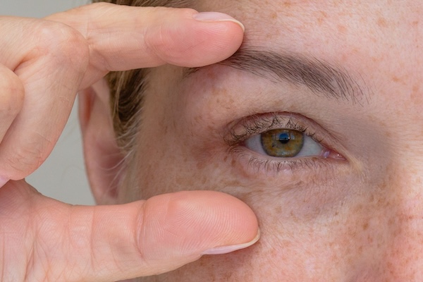 Loss of Elasticity / Tired Sagging Skin