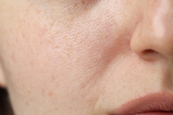 Rough / Uneven Texture