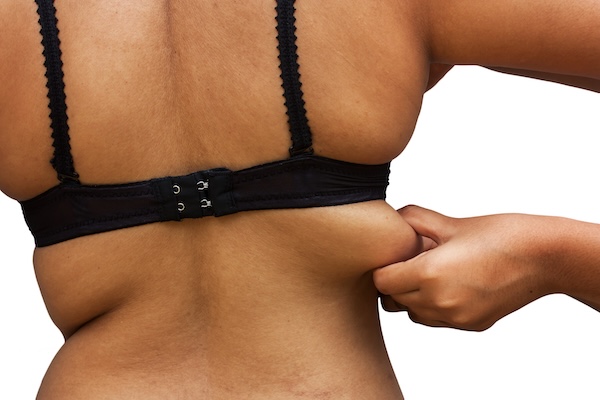 Bra Line / Back Fat