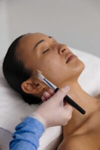 O Cosmedics chemical peel being applied at Shape of You Perth