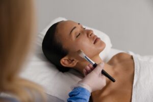 Cosmelan depigmentation peel being applied at Shape of You