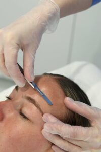 Dermaplaning facial at Shape of You Perth