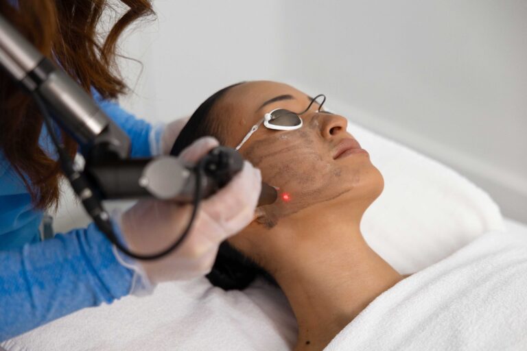 Hollywood Laser Carbon Peel treatment with carbon mask applied
