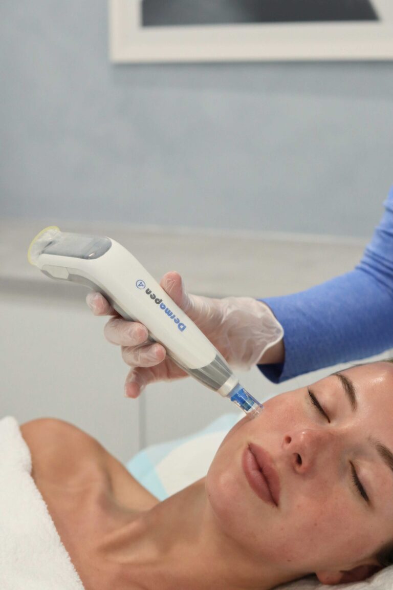 Dermapen skin needling treatment at Shape of You Perth