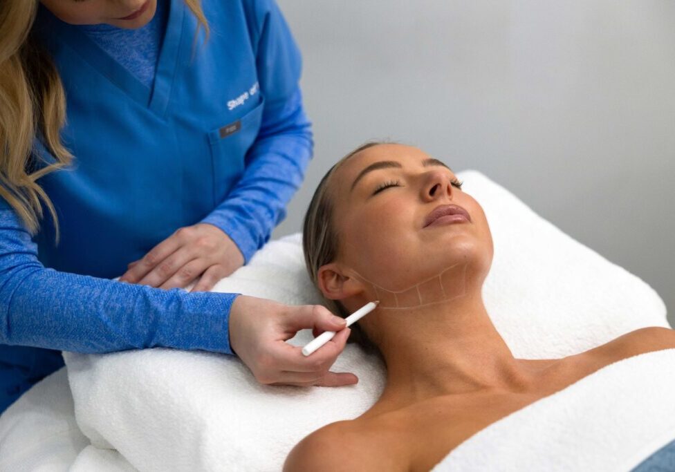 HIFU face mapping before an Ultraformer MPT treatment
